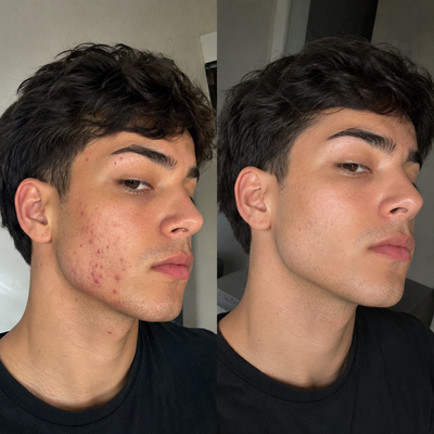 My skin looks so much clearer